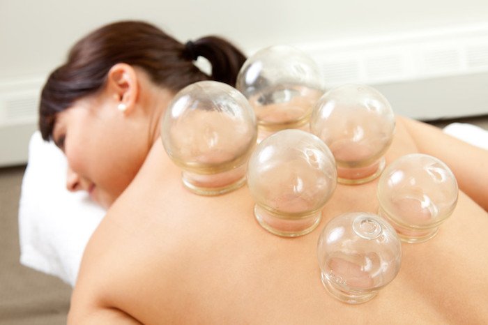 woman laying on stomach with glass bulbs on back skin suctioning the back as a traditional pain relief technique as one potential best pain relief affiliate programs