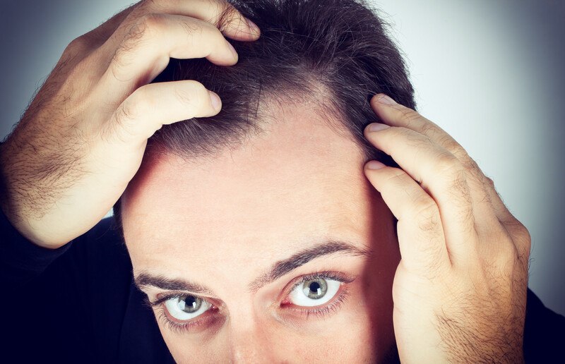 This image shows dark haired man looking up into a mirror, with his hands to his head as if he is investigating an area of thinning hair, representing the best hair loss affiliate programs.